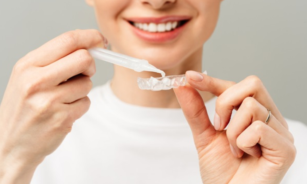 ホームホワイトニングを行う様子