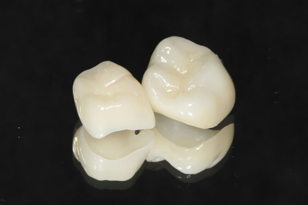 ハイブリッドレジン