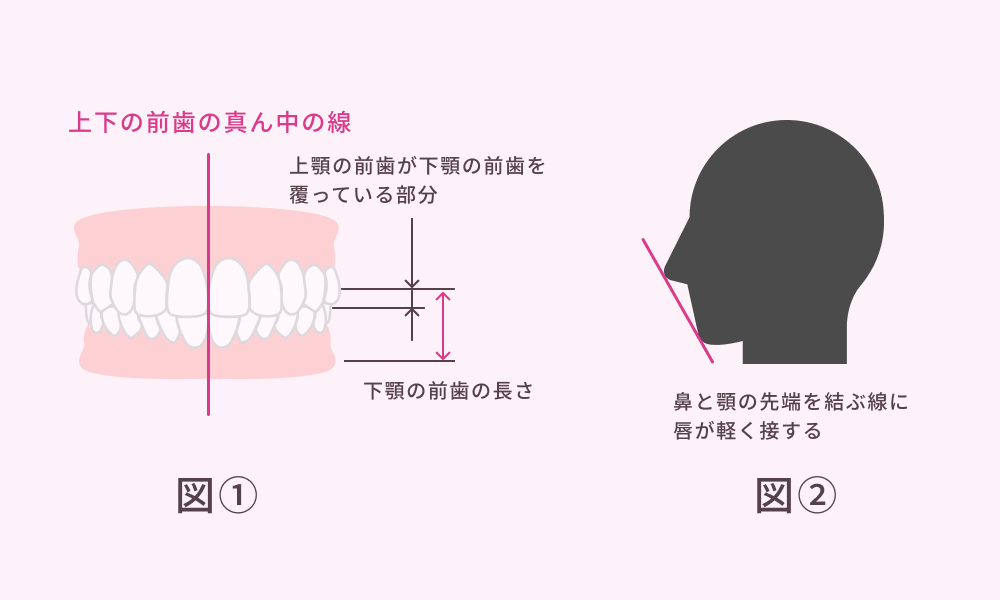 キレイな歯並びとは