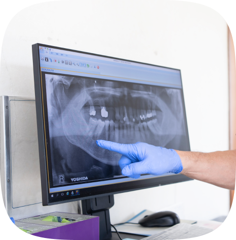 レントゲン撮影